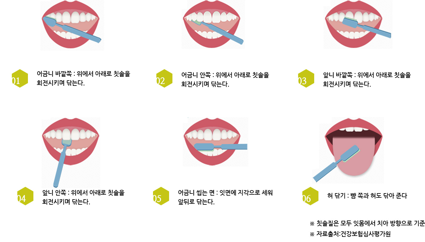 올바른 칫솔질